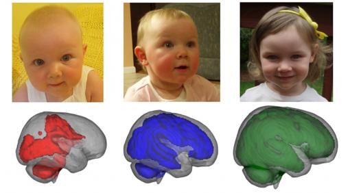 Babies' brains